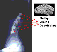 X-Rays of New Brains